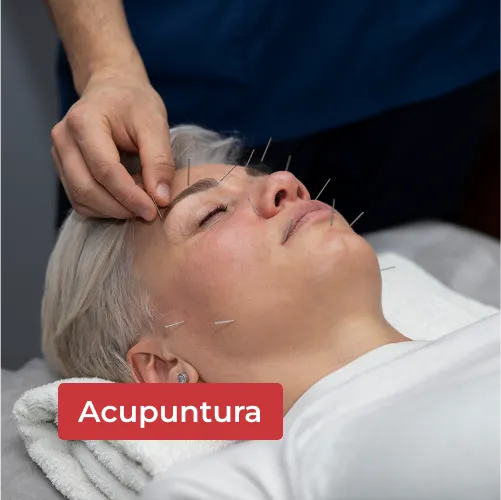 Acupuntura-Capa